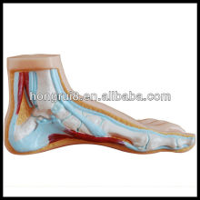 ISO Modèle de pied normal, plat et arqué, modèle anatomique